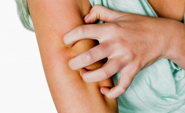Dermatite atopica: che cos’è e i cibi irritanti da evitare a tavola